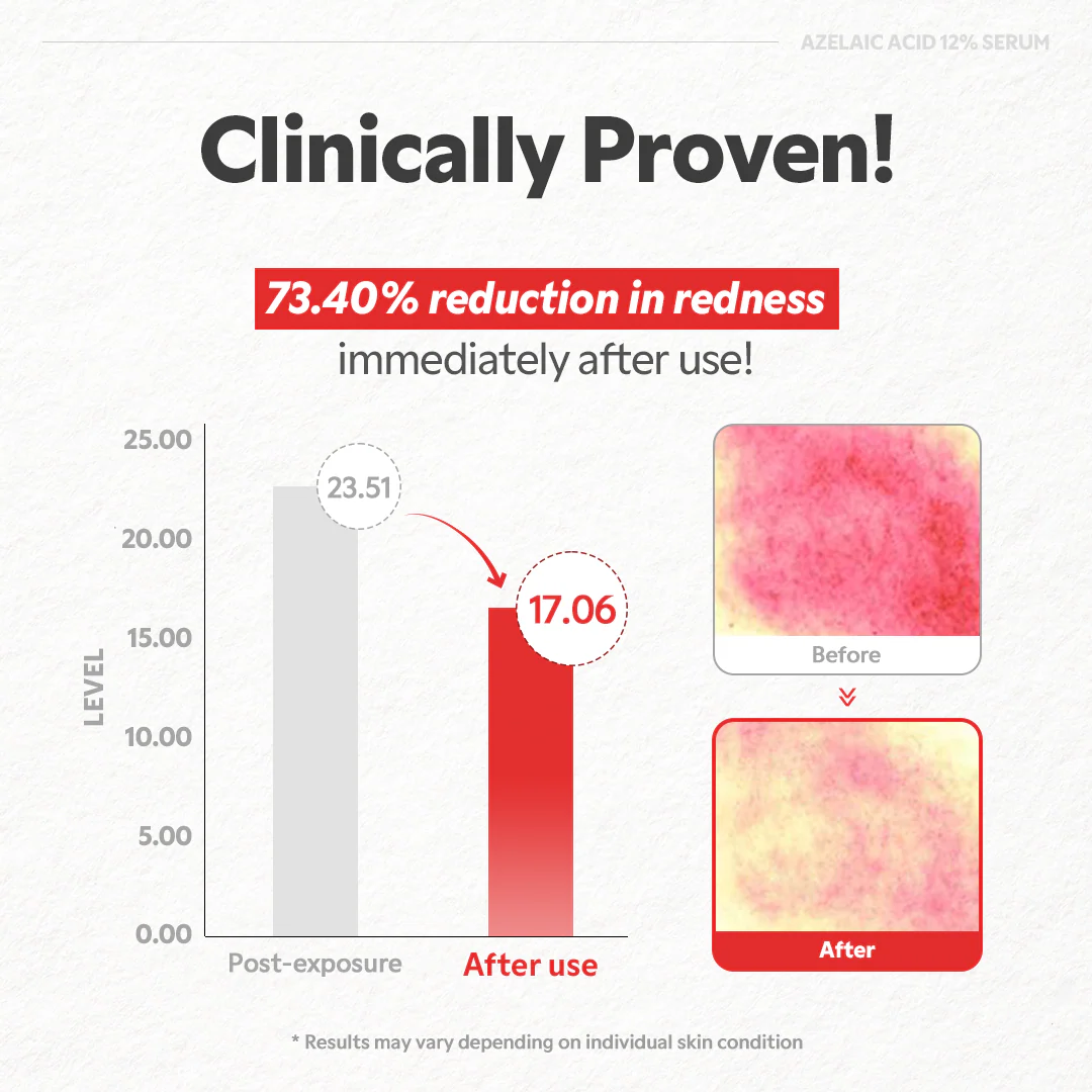 Azelaic Acid 12% Serum - Image 5