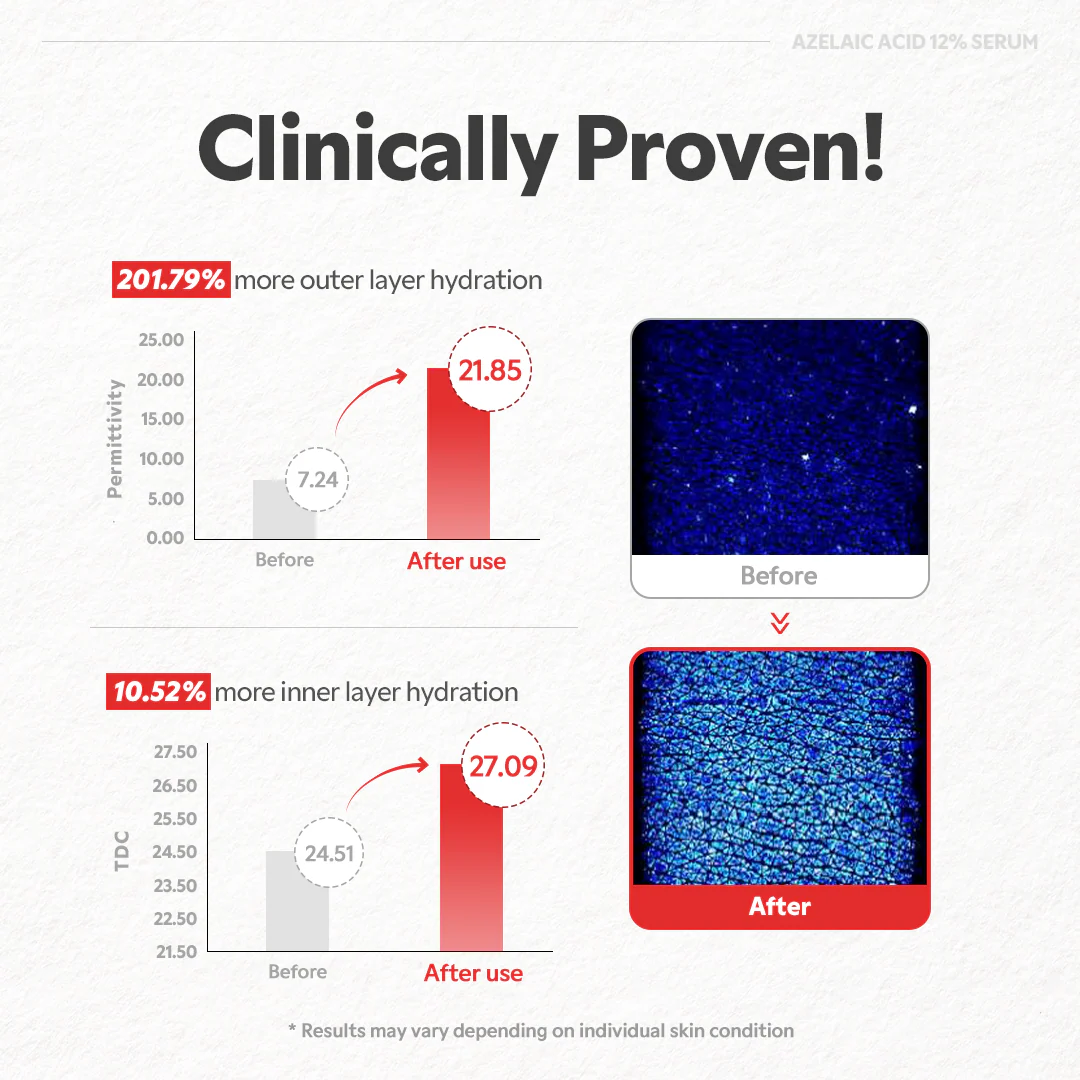 Azelaic Acid 12% Serum - Image 7